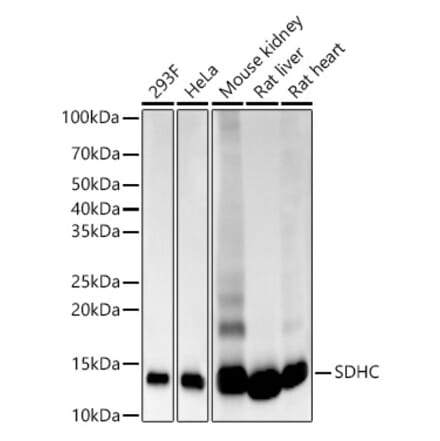 Western Blot - Anti-SDHC Antibody [ARC55260] (A306802) - Antibodies.com