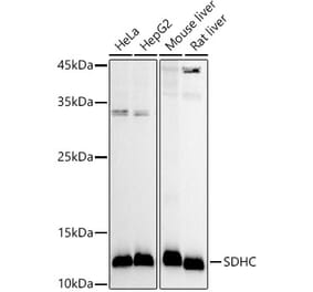 Western Blot - Anti-SDHC Antibody (A306803) - Antibodies.com