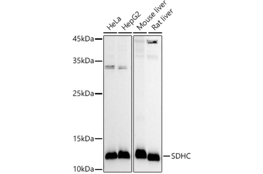 Western Blot - Anti-SDHC Antibody (A306803) - Antibodies.com