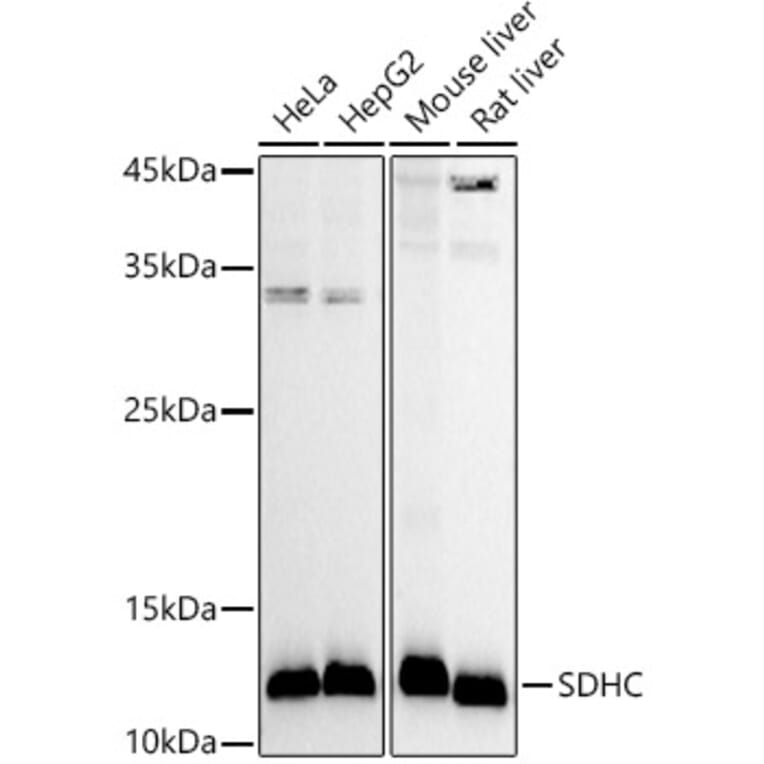 Western Blot - Anti-SDHC Antibody (A306803) - Antibodies.com