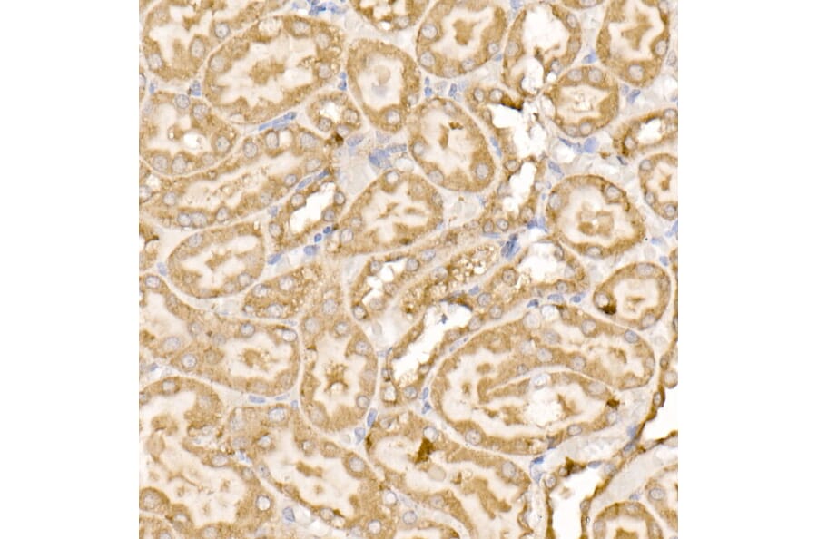 Immunohistochemistry - Anti-SDHC Antibody (A306803) - Antibodies.com