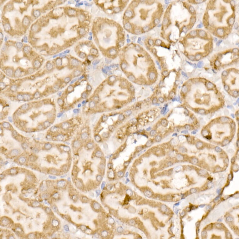 Immunohistochemistry - Anti-SDHC Antibody (A306803) - Antibodies.com