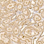 Immunohistochemistry - Anti-SDHC Antibody (A306803) - Antibodies.com