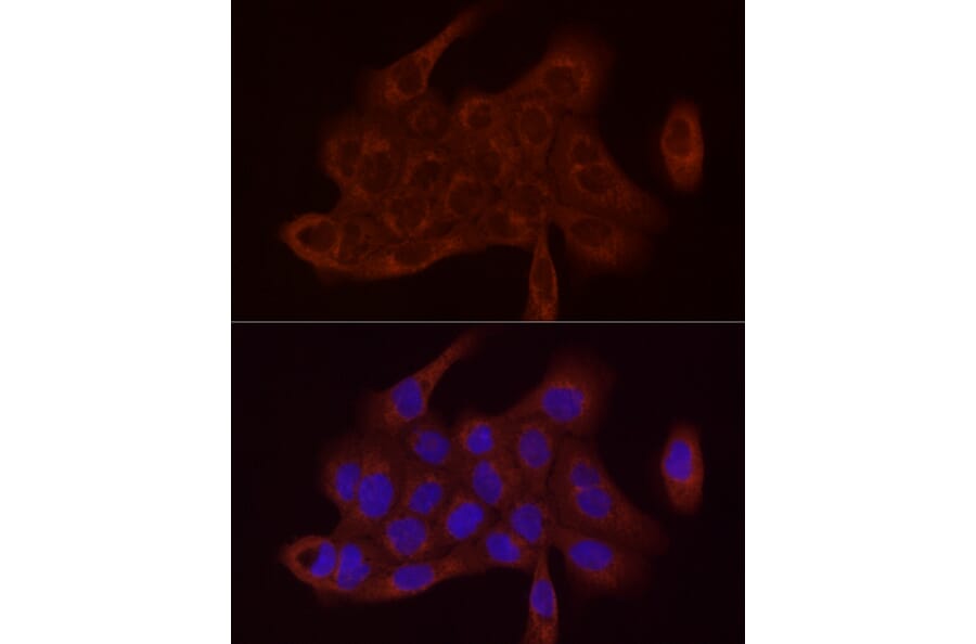 Immunofluorescence - Anti-SDHC Antibody (A306803) - Antibodies.com