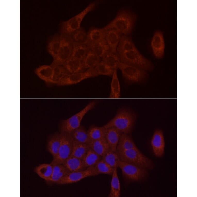 Immunofluorescence - Anti-SDHC Antibody (A306803) - Antibodies.com