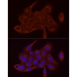 Immunofluorescence - Anti-SDHC Antibody (A306803) - Antibodies.com