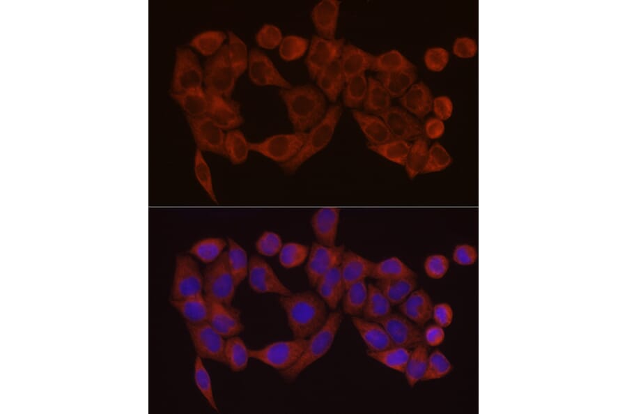 Immunofluorescence - Anti-SDHC Antibody (A306803) - Antibodies.com