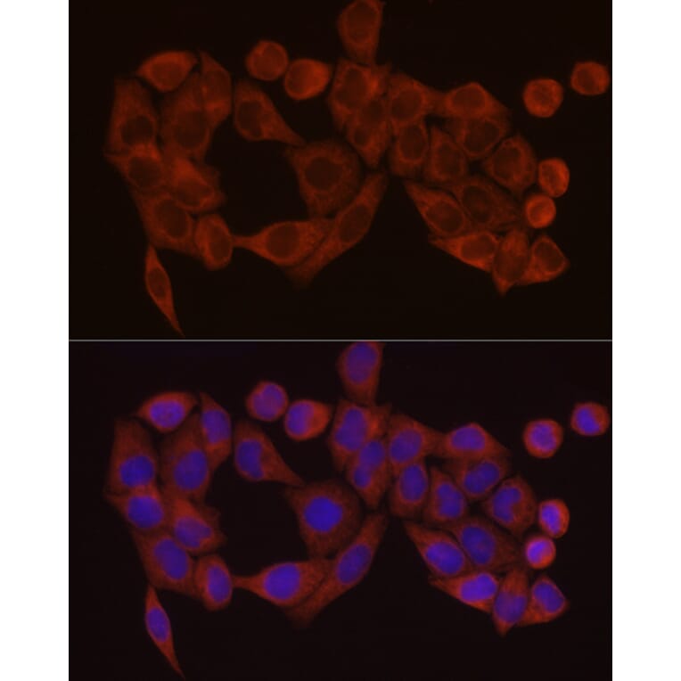 Immunofluorescence - Anti-SDHC Antibody (A306803) - Antibodies.com