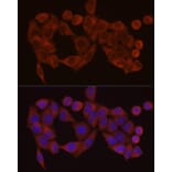 Immunofluorescence - Anti-SDHC Antibody (A306803) - Antibodies.com