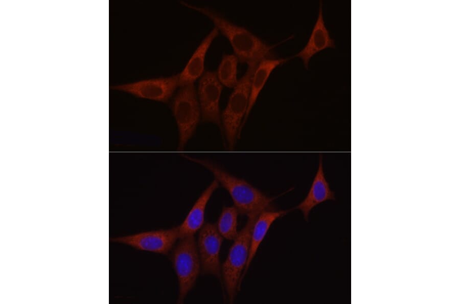 Immunofluorescence - Anti-SDHC Antibody (A306803) - Antibodies.com
