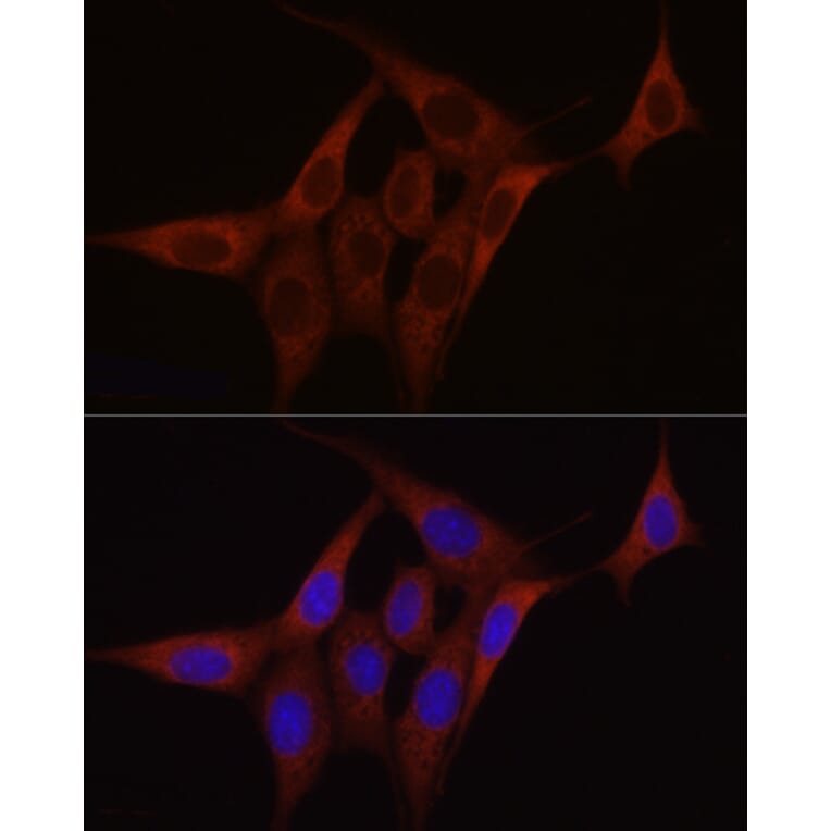 Immunofluorescence - Anti-SDHC Antibody (A306803) - Antibodies.com