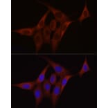Immunofluorescence - Anti-SDHC Antibody (A306803) - Antibodies.com