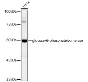 Western Blot - Anti-Glucose 6 Phosphate Isomerase Antibody [ARC0997] (A306804) - Antibodies.com