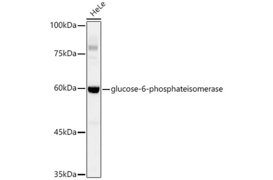 Western Blot - Anti-Glucose 6 Phosphate Isomerase Antibody [ARC0997] (A306804) - Antibodies.com