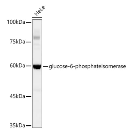 Western Blot - Anti-Glucose 6 Phosphate Isomerase Antibody [ARC0997] (A306804) - Antibodies.com