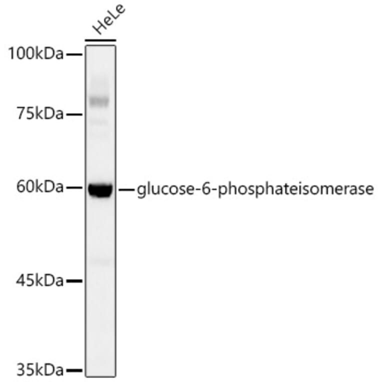Western Blot - Anti-Glucose 6 Phosphate Isomerase Antibody [ARC0997] (A306804) - Antibodies.com