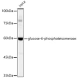 Western Blot - Anti-Glucose 6 Phosphate Isomerase Antibody [ARC0997] (A306804) - Antibodies.com