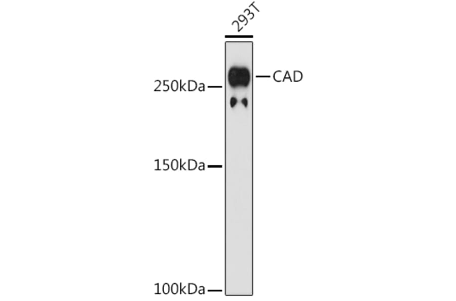 Western Blot - Anti-CAD/BM1 Antibody [ARC1426] (A306805) - Antibodies.com