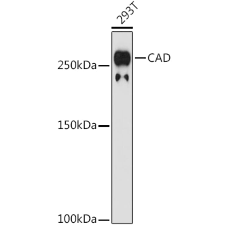 Western Blot - Anti-CAD/BM1 Antibody [ARC1426] (A306805) - Antibodies.com