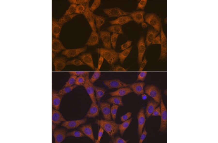 Immunofluorescence - Anti-CAD/BM1 Antibody [ARC1426] (A306805) - Antibodies.com