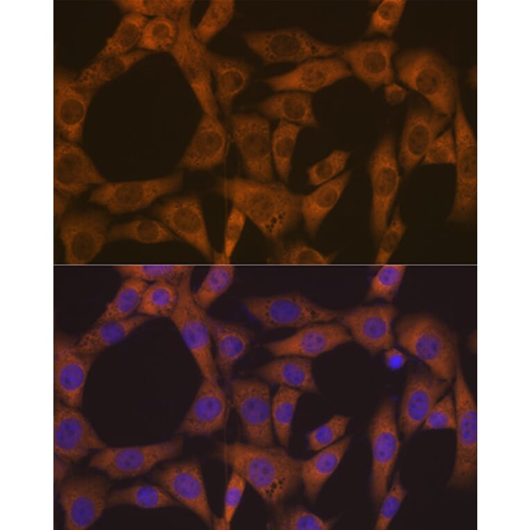Immunofluorescence - Anti-CAD/BM1 Antibody [ARC1426] (A306805) - Antibodies.com