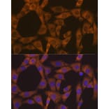 Immunofluorescence - Anti-CAD/BM1 Antibody [ARC1426] (A306805) - Antibodies.com