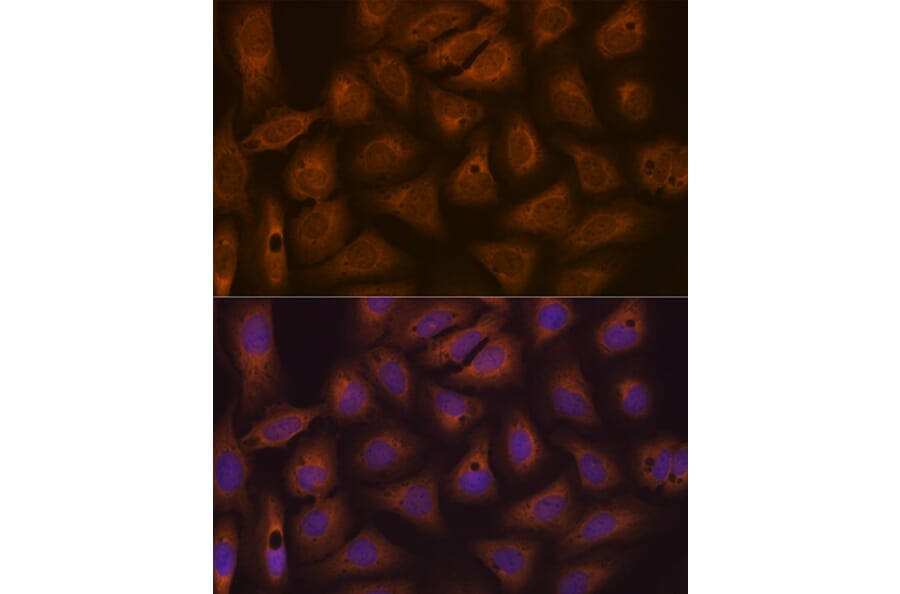 Immunofluorescence - Anti-CAD/BM1 Antibody [ARC1426] (A306805) - Antibodies.com