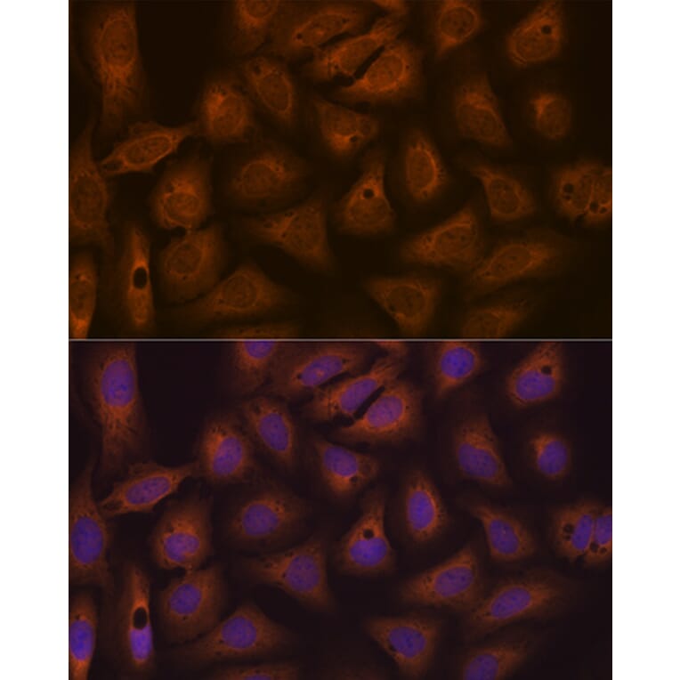 Immunofluorescence - Anti-CAD/BM1 Antibody [ARC1426] (A306805) - Antibodies.com