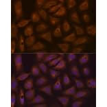 Immunofluorescence - Anti-CAD/BM1 Antibody [ARC1426] (A306805) - Antibodies.com