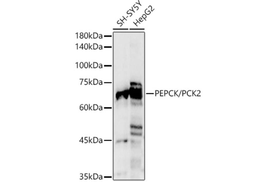 Western Blot - Anti-PCK2 Antibody (A306806) - Antibodies.com