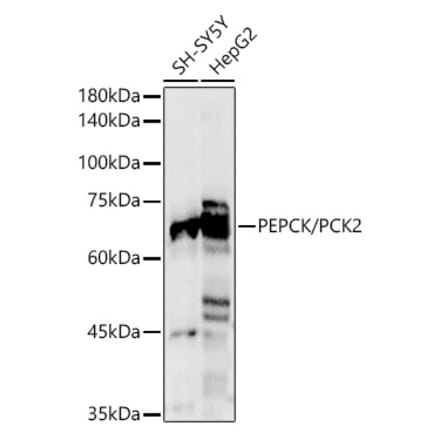 Western Blot - Anti-PCK2 Antibody (A306806) - Antibodies.com