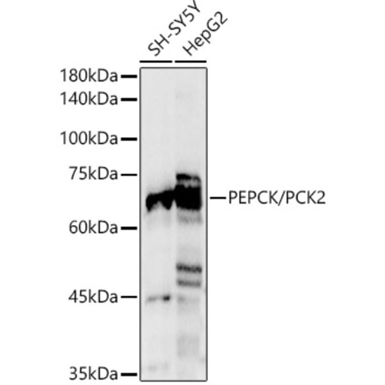 Western Blot - Anti-PCK2 Antibody (A306806) - Antibodies.com