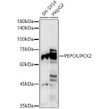 Western Blot - Anti-PCK2 Antibody (A306806) - Antibodies.com