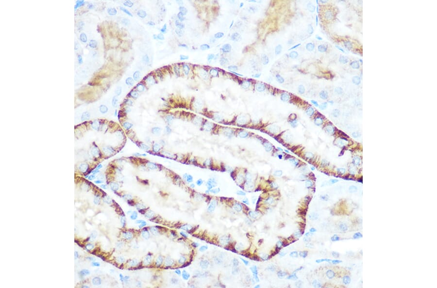 Immunohistochemistry - Anti-PCK2 Antibody (A306806) - Antibodies.com