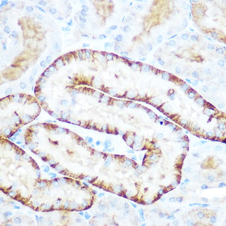 Immunohistochemistry - Anti-PCK2 Antibody (A306806) - Antibodies.com