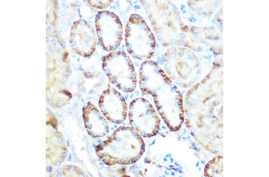 Immunohistochemistry - Anti-PCK2 Antibody (A306806) - Antibodies.com