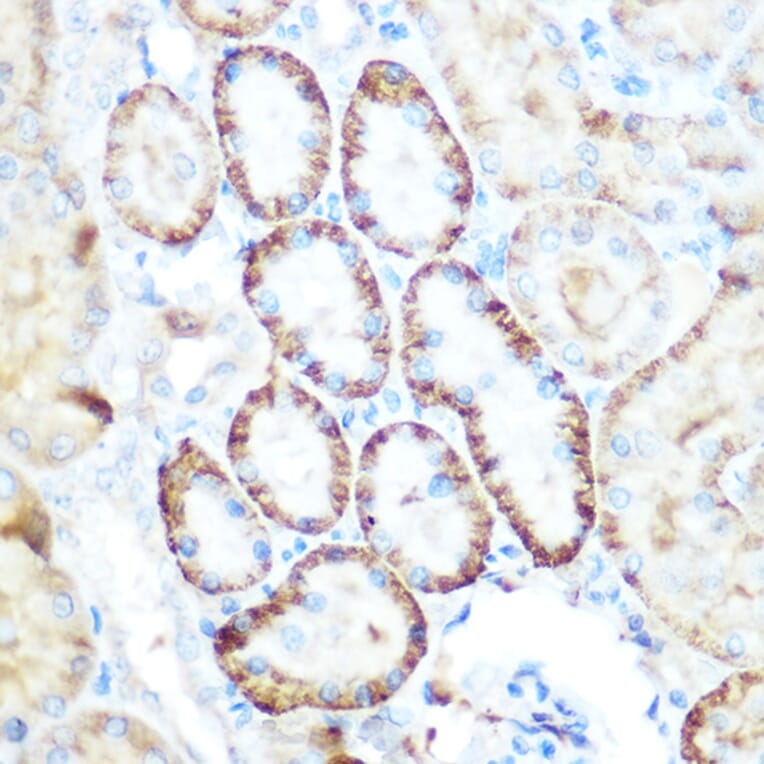 Immunohistochemistry - Anti-PCK2 Antibody (A306806) - Antibodies.com