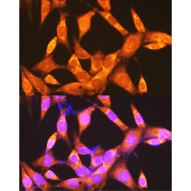 Immunofluorescence - Anti-PCK2 Antibody (A306806) - Antibodies.com