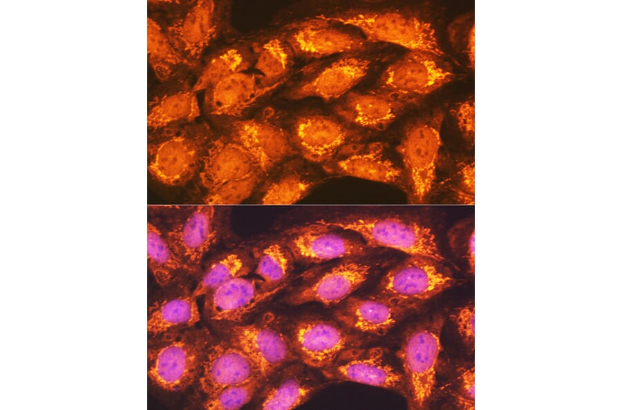 Immunofluorescence - Anti-PCK2 Antibody (A306806) - Antibodies.com