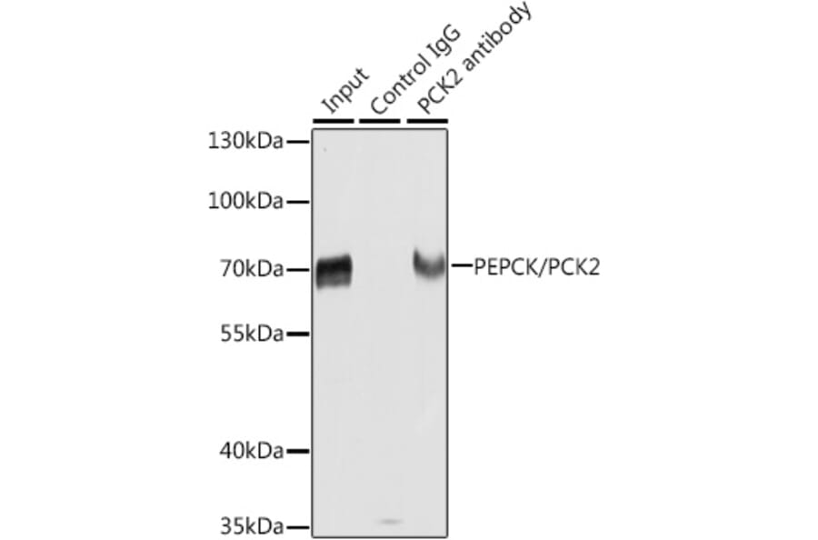 Western Blot - Anti-PCK2 Antibody (A306806) - Antibodies.com