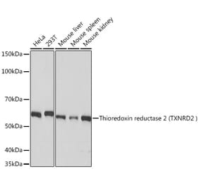 Western Blot - Anti-TXNRD2 Antibody [ARC1339] (A306807) - Antibodies.com