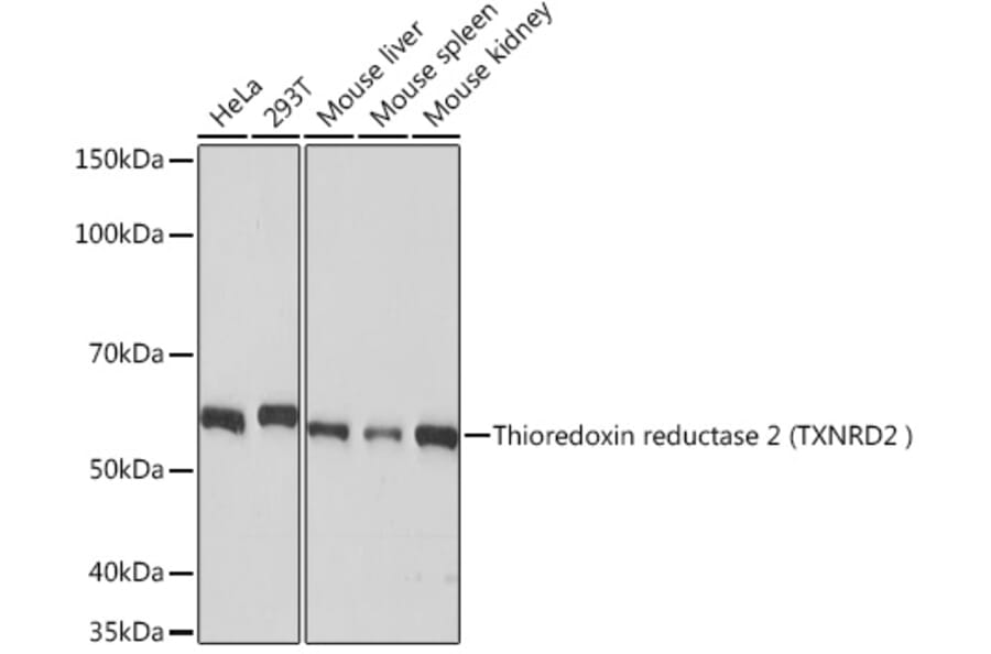 Western Blot - Anti-TXNRD2 Antibody [ARC1339] (A306807) - Antibodies.com