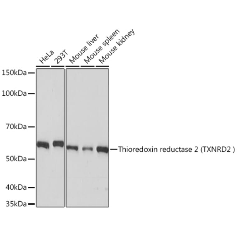 Western Blot - Anti-TXNRD2 Antibody [ARC1339] (A306807) - Antibodies.com