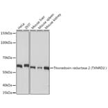 Western Blot - Anti-TXNRD2 Antibody [ARC1339] (A306807) - Antibodies.com