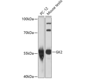 Western Blot - Anti-GK2 Antibody (A306809) - Antibodies.com