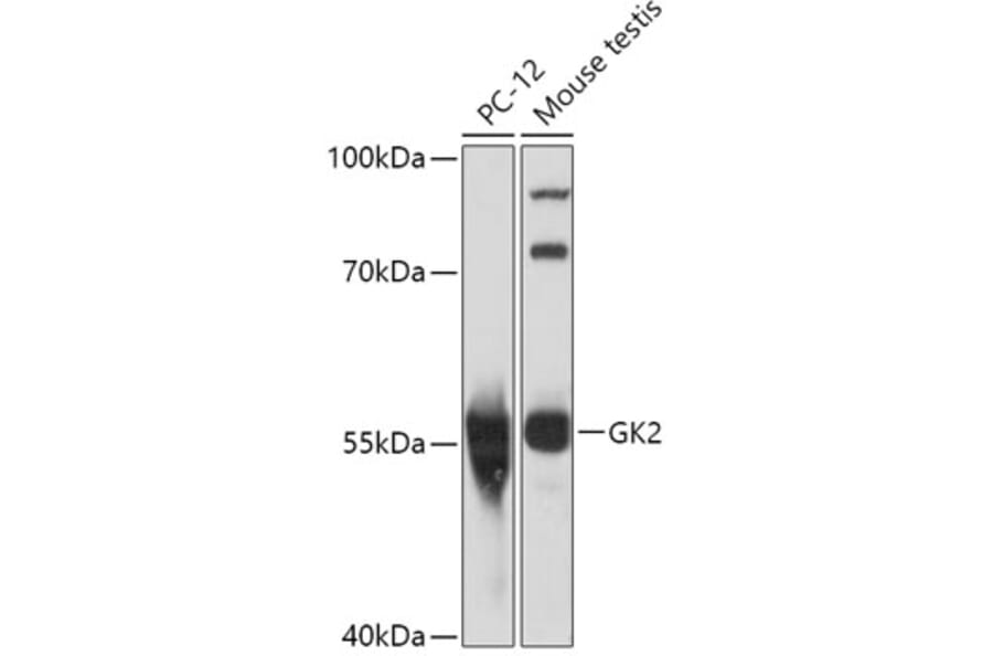 Western Blot - Anti-GK2 Antibody (A306809) - Antibodies.com