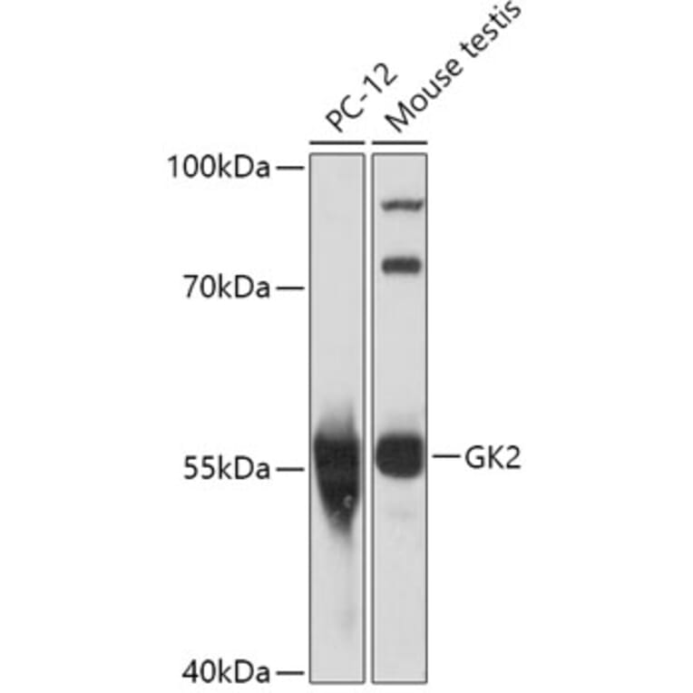Western Blot - Anti-GK2 Antibody (A306809) - Antibodies.com