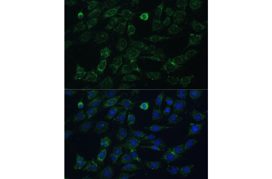 Immunofluorescence - Anti-GK2 Antibody (A306809) - Antibodies.com