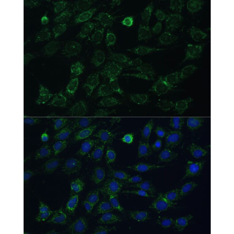 Immunofluorescence - Anti-GK2 Antibody (A306809) - Antibodies.com