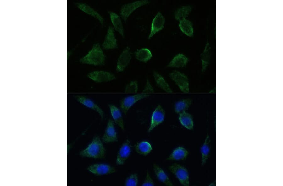 Immunofluorescence - Anti-GK2 Antibody (A306809) - Antibodies.com